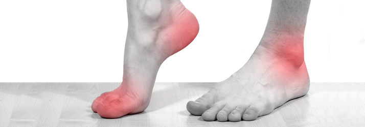 Neuropathy in Midlothian VA Neuropathy in Midlothian VA